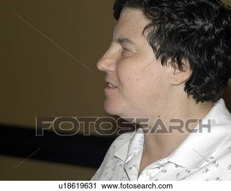 Stock Image - Woman with a visual impairment/blindness.. Fotosearch