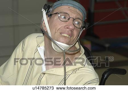 Stock Image - Close up of man with significant disabilities.. Fotosearch