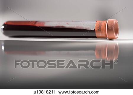 Closeup of blood sample in tube View Large Photo Image Stock Image - Closeup of blood sample in tube. Fotosearch