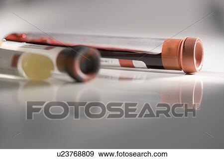 Closeup of blood samples in tubes View Large Photo Image Stock Photo - Closeup of blood samples in tubes. Fotosearch