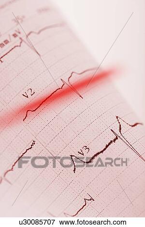 Stock Photo - Closeup of heart monitor printout. Fotosearch