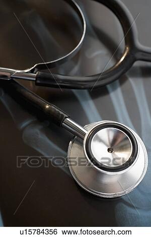 Close up of stethoscope on x-ray View Large Photo Image Stock Photograph - Close up of stethoscope on x-ray. Fotosearch