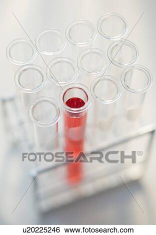 Close up of vials in tray View Large Photo Image Stock Photograph - Close up of vials in tray . Fotosearch