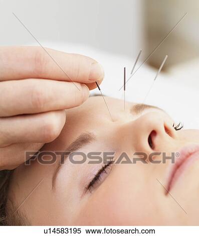 Woman receiving acupuncture View Large Photo Image Stock Photography - Woman receiving acupuncture. Fotosearch
