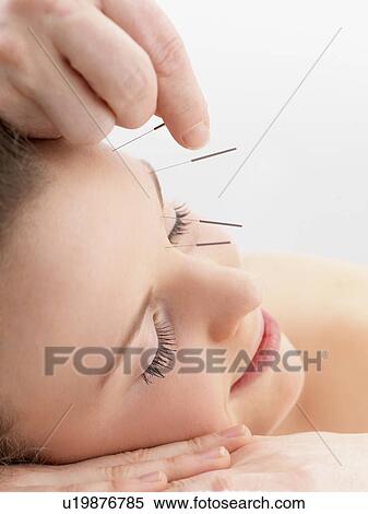 Woman receiving acupuncture View Large Photo Image Stock Photography - Woman receiving acupuncture. Fotosearch