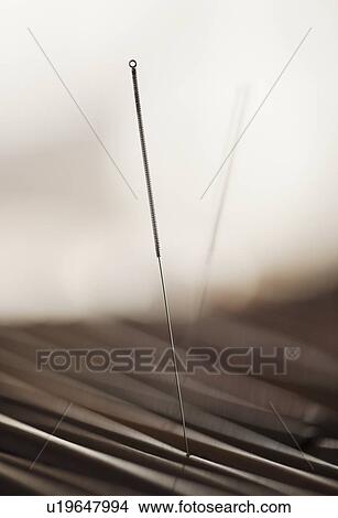 Close up of acupuncture needle View Large Photo Image Picture - Close up of acupuncture needle. Fotosearch