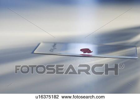 Stock Image - Drop of blood on slide. Fotosearch