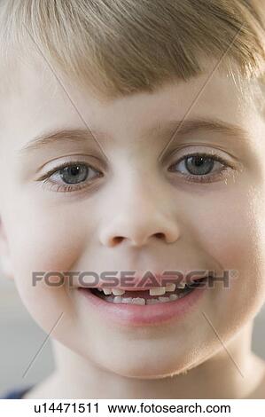 Portrait of boy with missing teeth View Large Photo Image Stock Image - Portrait of boy with missing teeth. Fotosearch