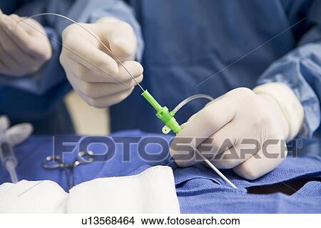 사진 - 외과의사, 삽입, 튜브, 으로, 환자, 동안에, 외과. Fotosearch