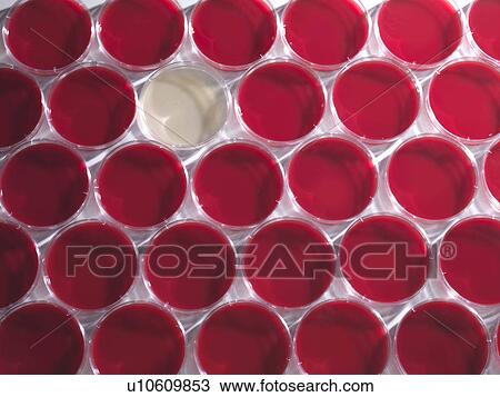 Petri dishes in rows View Large Photo Image Stock Image - Petri dishes in rows. Fotosearch
