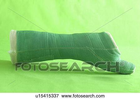A removed cast View Large Photo Image Stock Photo - A removed cast. Fotosearch