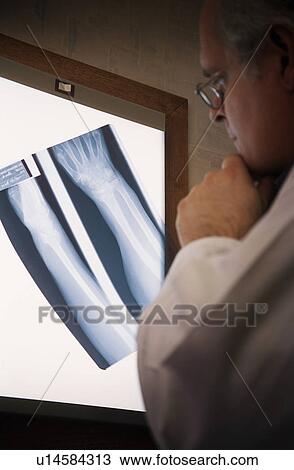 Stock Image - Doctor examining x-ray. Fotosearch