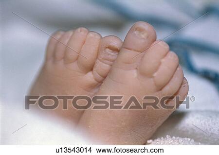 Picture - Newborn feet. Fotosearch