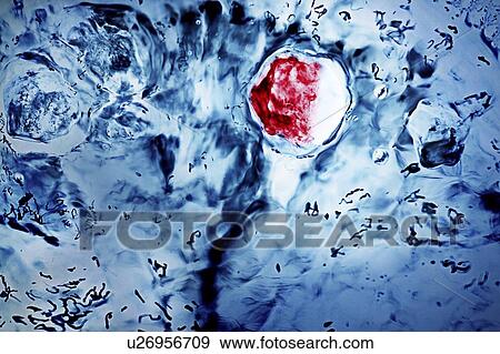 Stock Photo - View of bacteria from microscope. Fotosearch