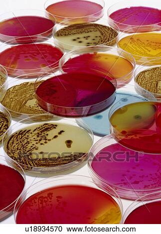 Petri dishes with Bacteria View Large Photo Image Stock Image - Petri dishes with Bacteria. Fotosearch