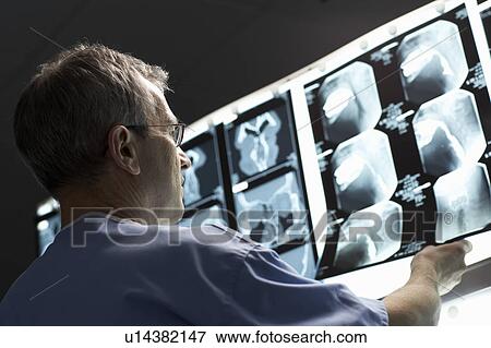 Stock Photo - Doctor looking at x-rays. Fotosearch