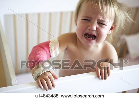 Stock Photo - Crying Toddler With Arm In Cast. Fotosearch