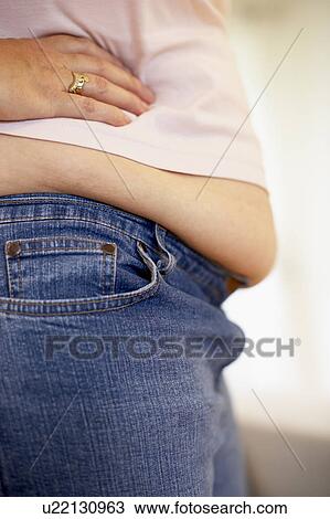 Stock Image - Detail Of Overweight Woman. Fotosearch