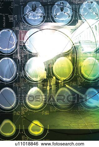 geometric, brain scan, arrangement, pattern, overlay, shape, light View Large Photo Image Stock Photograph - geometric, brain scan, arrangement, pattern, overlay, shape, light. Fotosearch