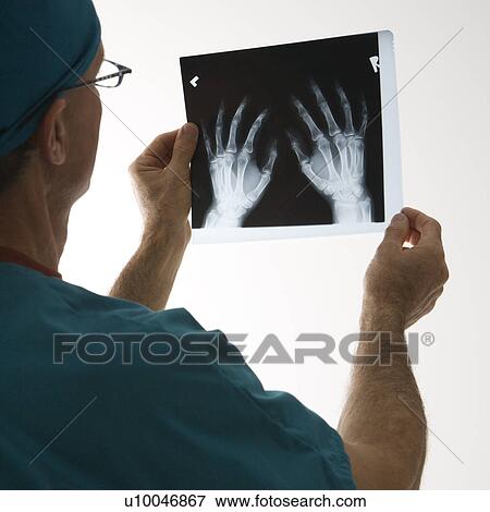 Stock Photo - Mid-adult Caucasian male doctor holding an x-ray.. Fotosearch