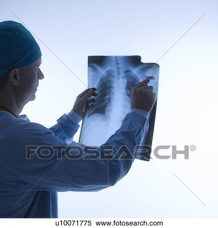 Stock Photography - Mid-adult Caucasian male doctor pointing at an x-ray.. Fotosearch