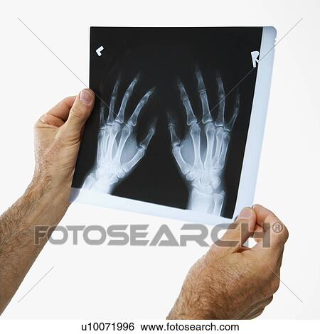 Mid-adult Caucasian male holding a x-ray. View Large Photo Image Stock Photograph - Mid-adult Caucasian male holding a x-ray.. Fotosearch