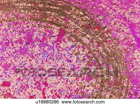 pattern, grain, scratch, texture, background View Large Photo Image Stock Photograph - pattern, grain, scratch, texture, background. Fotosearch